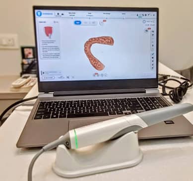 Slider image (6) Smilora Dental Clinic in Mumbai, India